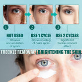 South Moon Brightening Spot Whitening Cream Moisturizing - Lifestil. www.Lifestil.net