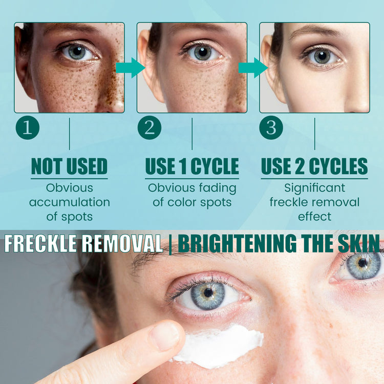 South Moon Brightening Spot Whitening Cream Moisturizing - Lifestil. www.Lifestil.net