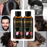 2pcs*100g Biotin Rosemary Onion Trio Shampoo & Conditioner Set, with Plant Keratin and Argan Oil Core Ingredients, Rich Lather for Easy Rinse, Removes Loose Dandruff, Strengthens Hair, Repairs Split Ends, Restores Dry/Damaged - Lifestil. www.Lifestil.net