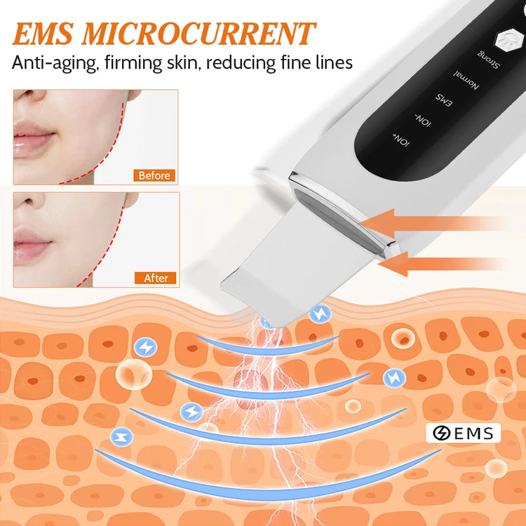 Ultrasonic Skin Scrubber 5 Modes LED Red Blue Light EMS - Lifestil. www.Lifestil.net